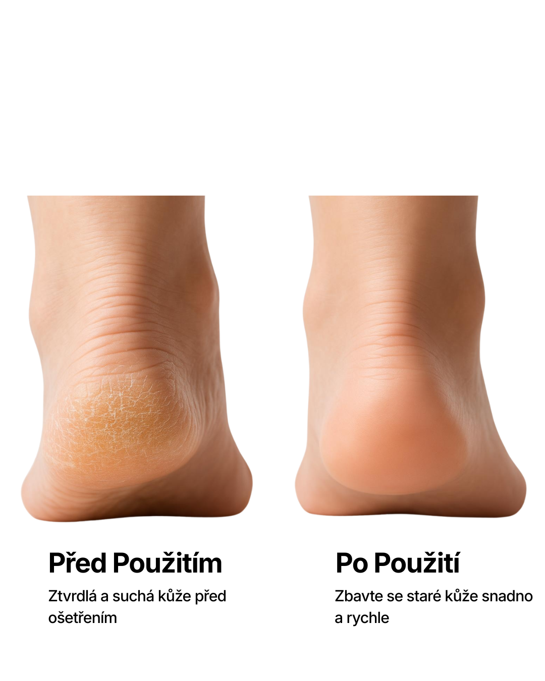 PILNIA – Hladké paty bez bolesti během 5 minut