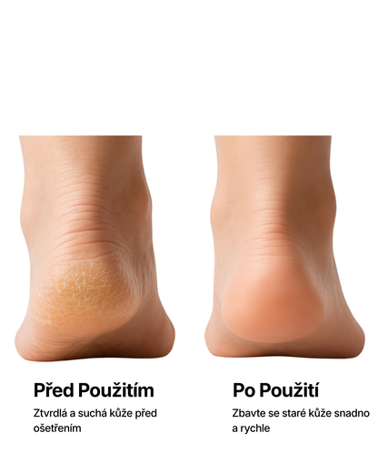PILNIA – Hladké paty bez bolesti během 5 minut
