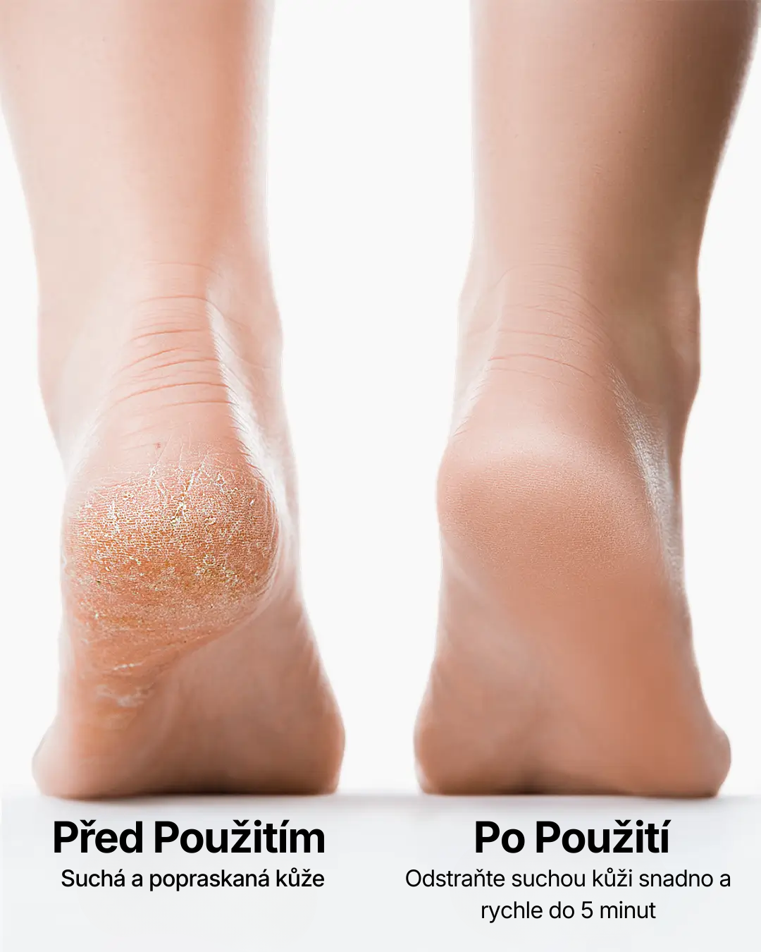 PILNIA – Hladké paty bez bolesti během 5 minut